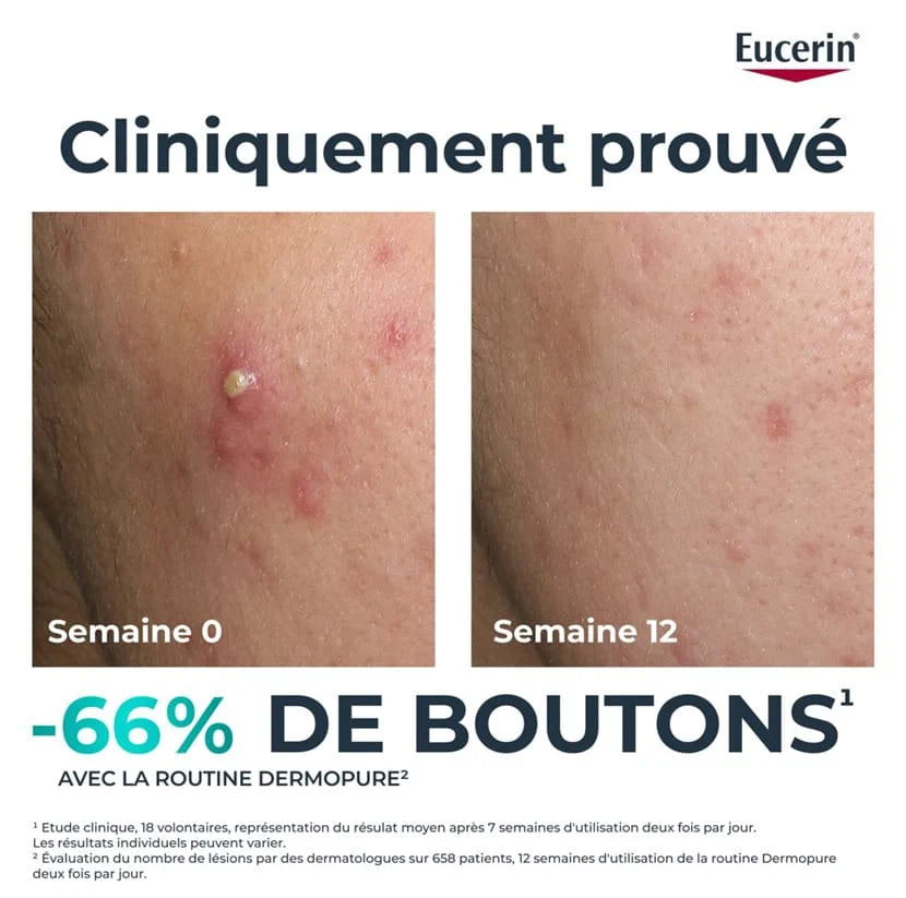 Eucerin DermoPure Sérum Triple Action